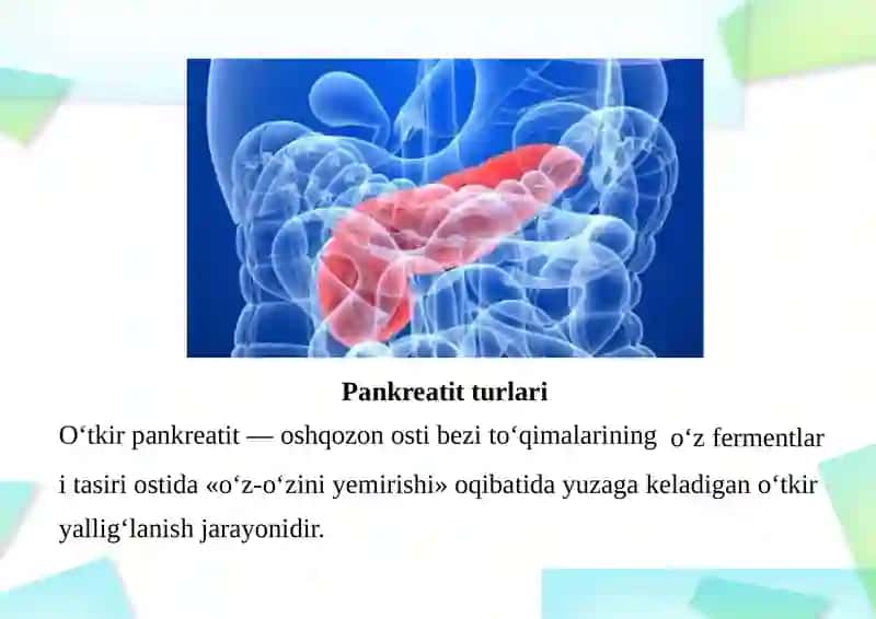 O‘tkir pankreatit 2