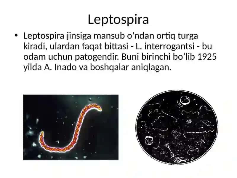 LEPTOSPIROZLAR 2