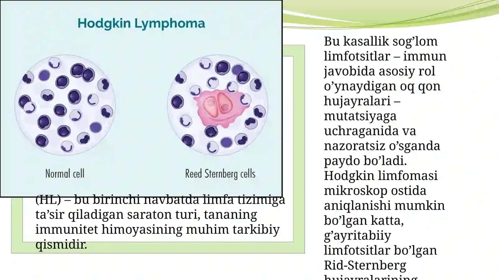 Xodgkin va Non-Xodgkin limfomasi 2
