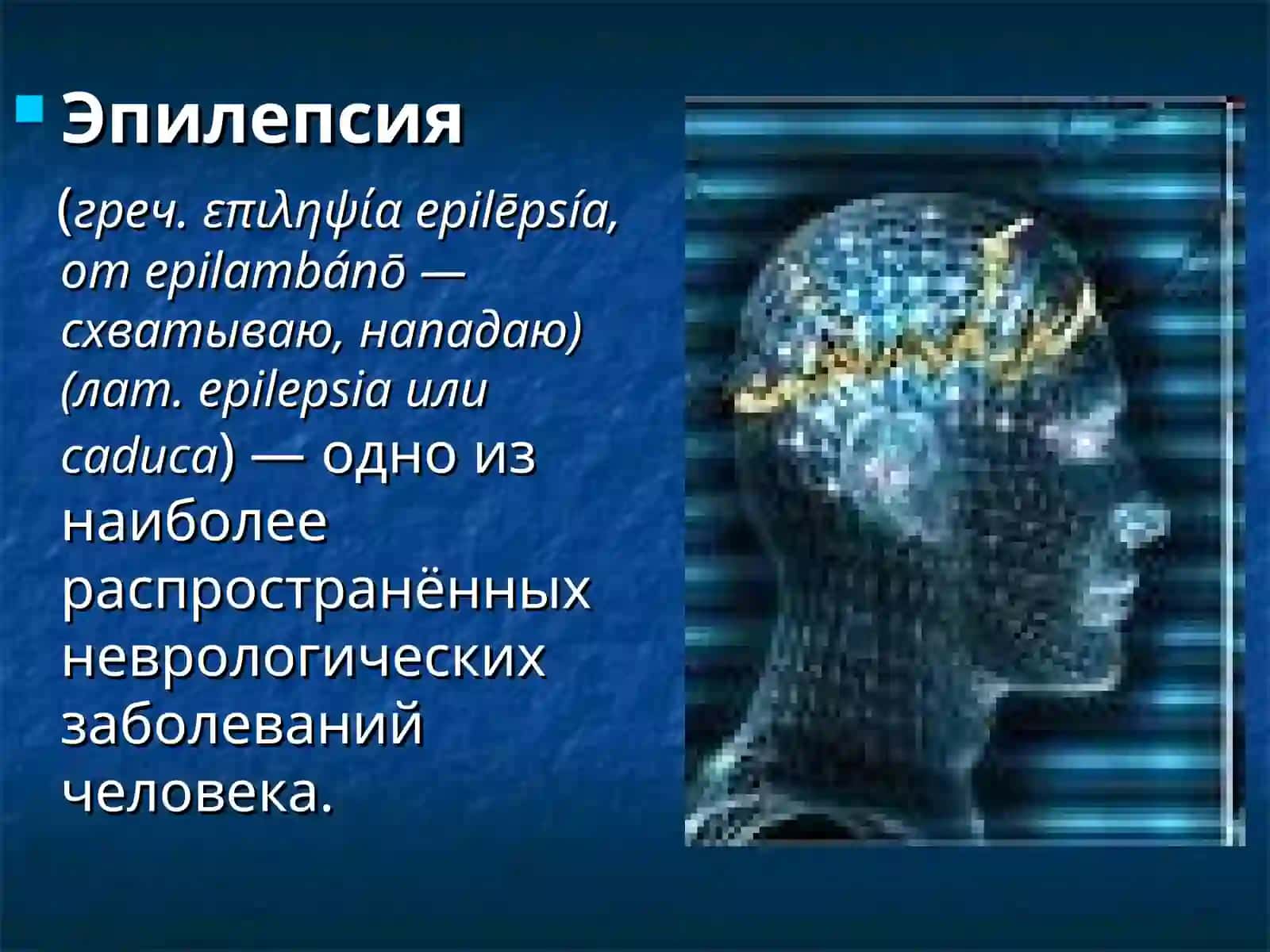 Эпилепсия 2