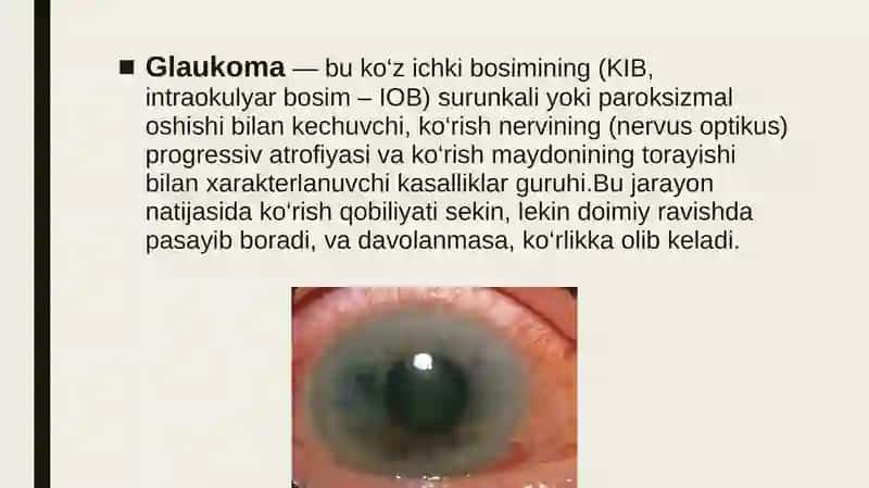 Glaukoma 2