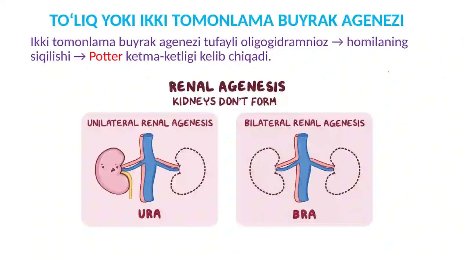 BUYRAK VA SIYDIK YO’LLARI KASALLIKLARI 2