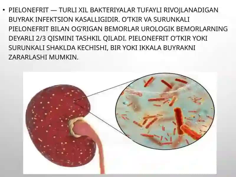 Oʻtkir va surunka li pielonefrit 2