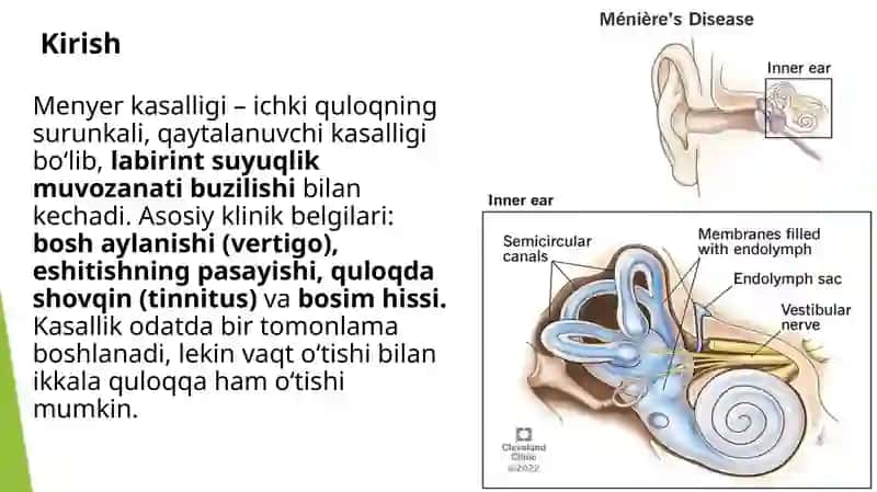 Mener kasalligi va zamonaviy davolash usullari 2