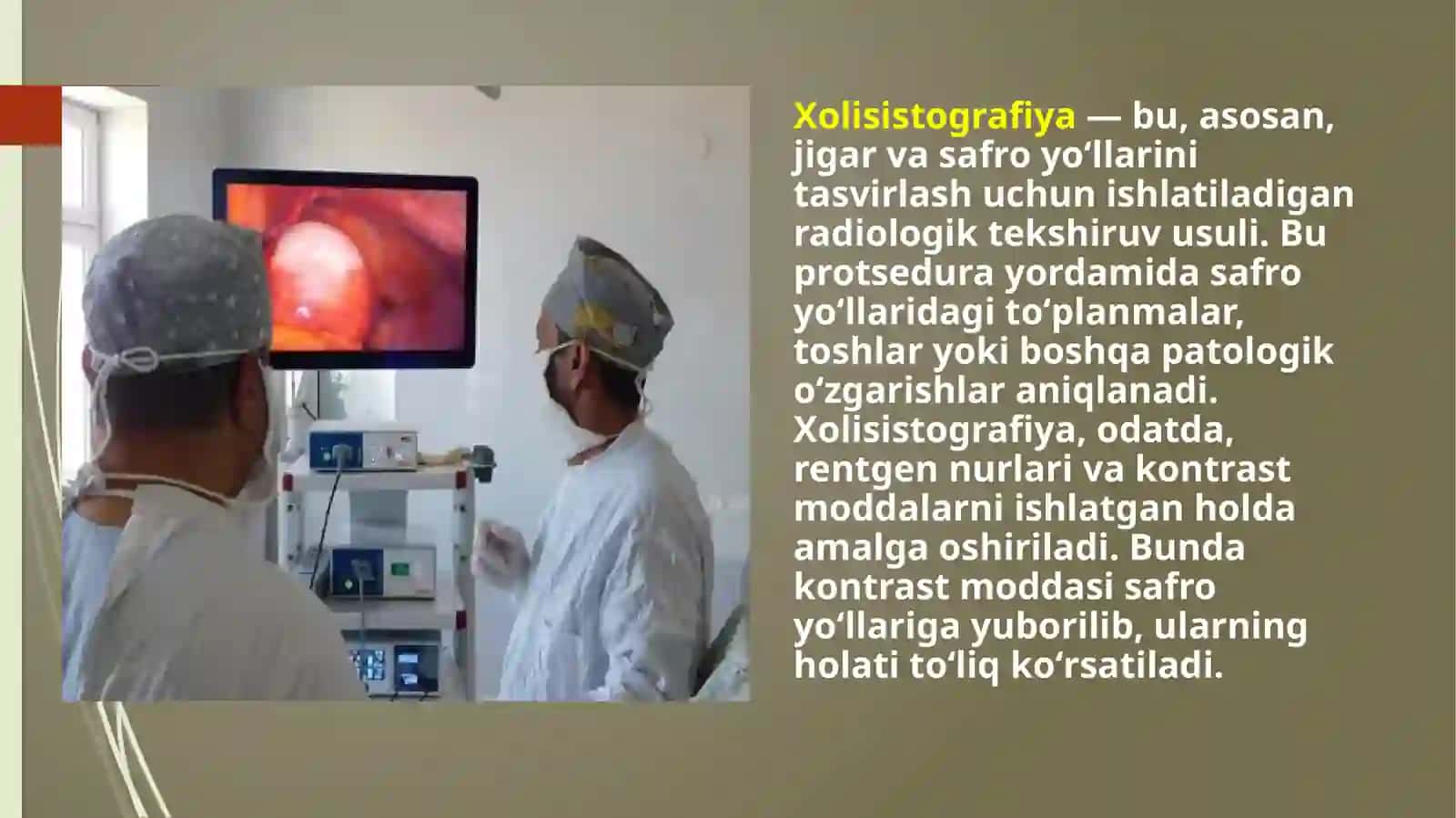 Xolisistografiya 2