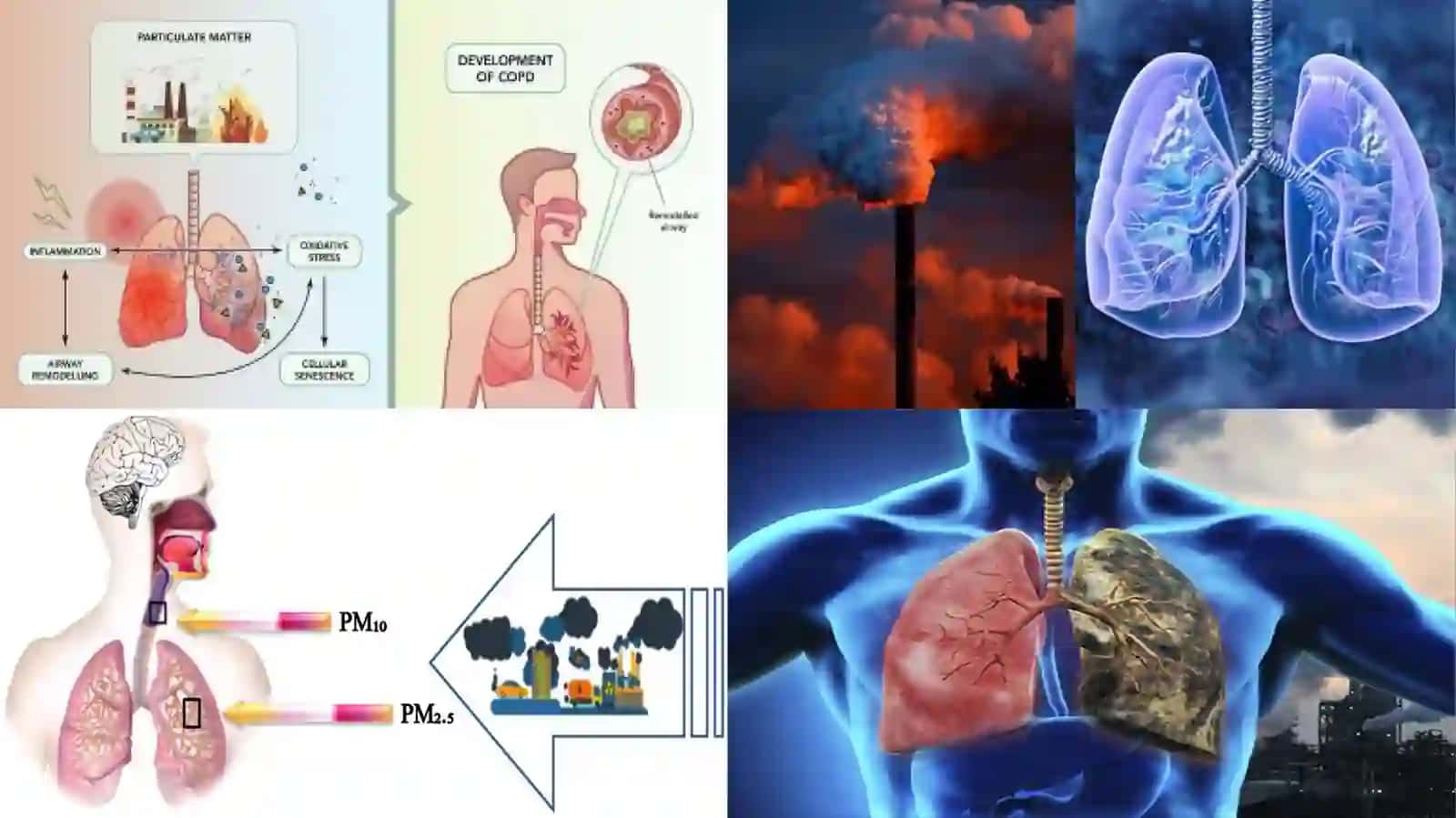 Havo ifloslanishining o'pka patologiyasidagi ahamiyati 2