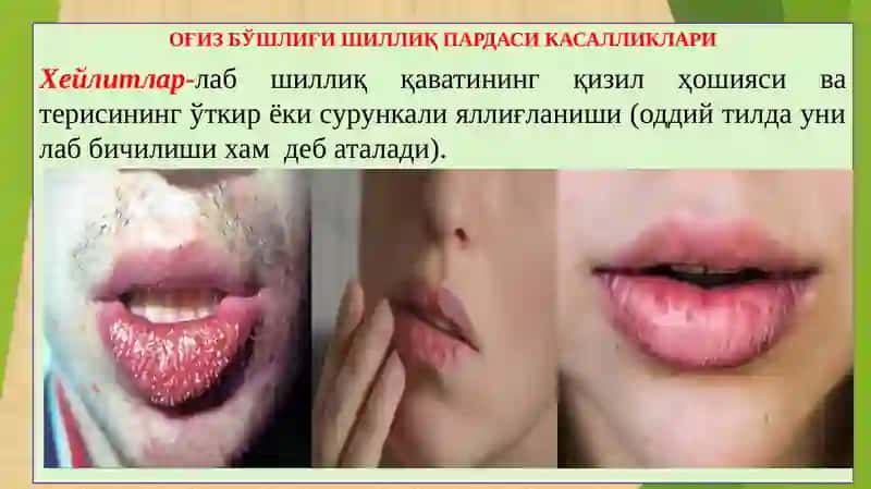 ПАТОЛОГИК АНАТОМИЯ 2