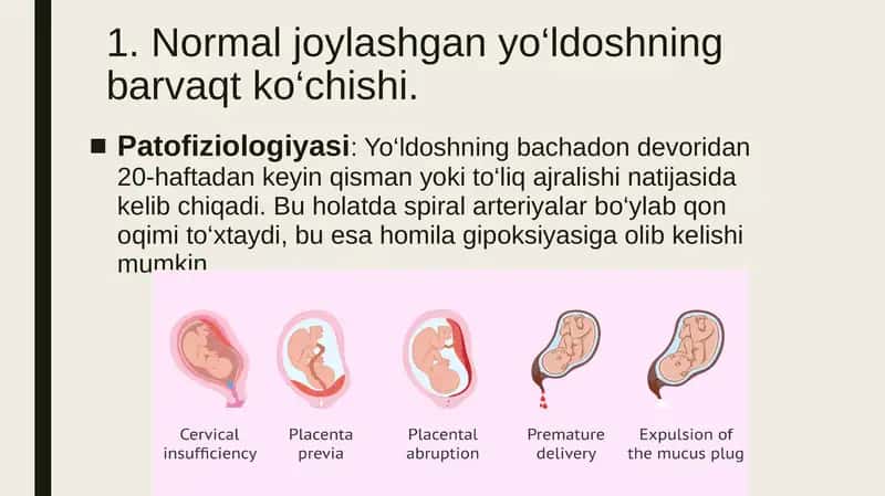 Yo‘ldoshning normal joylashgan barvaqt kuchishi 2