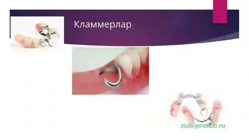 Кламмерлар 2