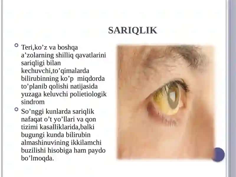3 xilkoʻrinishdagisariqlikpatogonezi 2