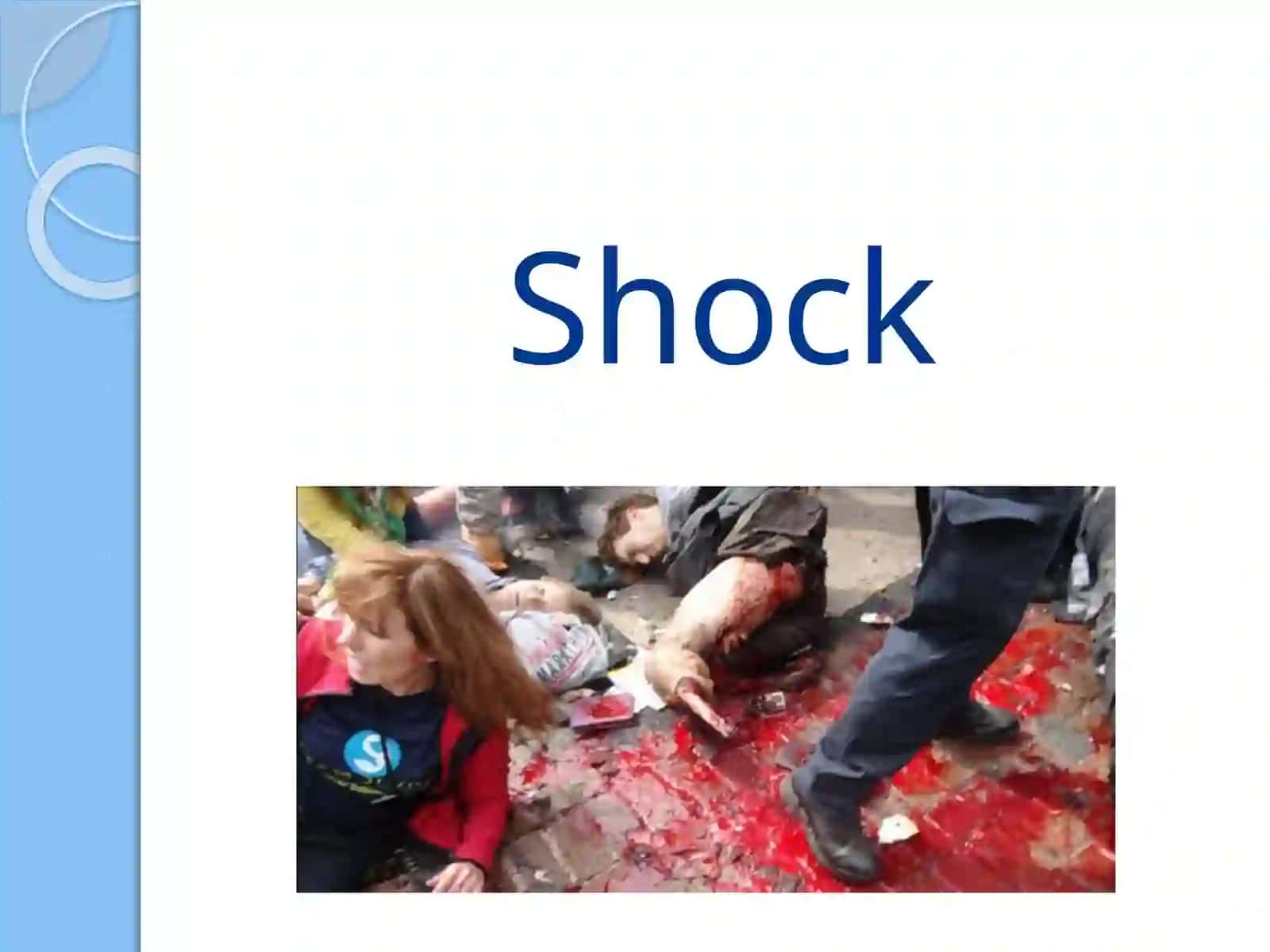 Shock, Spinal injury 2