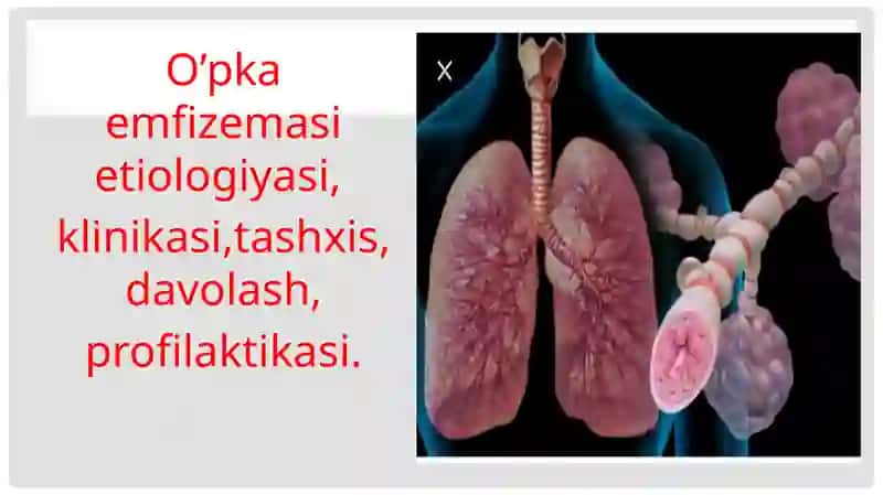 O’PKAEMFIZEMASI 2