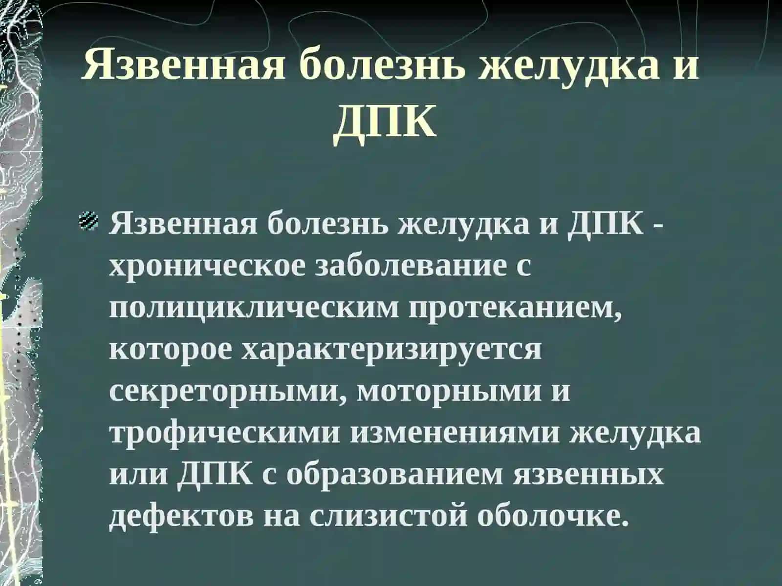 Язвенная болезнь  желудка и ДПК 2