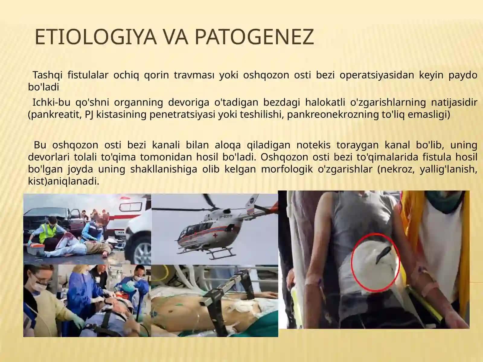 Oshqozonosti bezi fistulalari 2