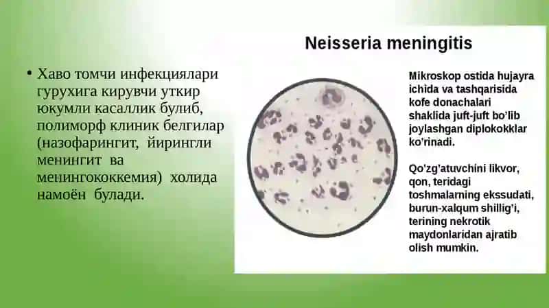 МЕНИНГОКОКК ИНФЕКЦИЯСИ 2