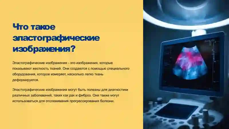 Основы эластографии 2