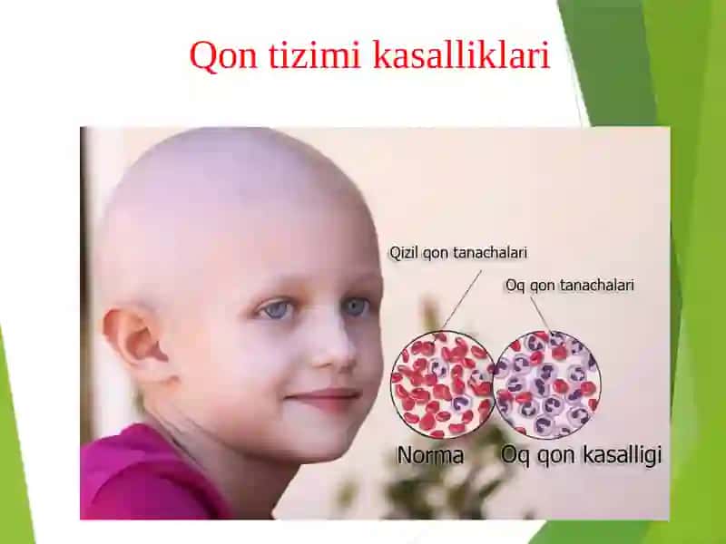 qon tizimi kasalliklari 2