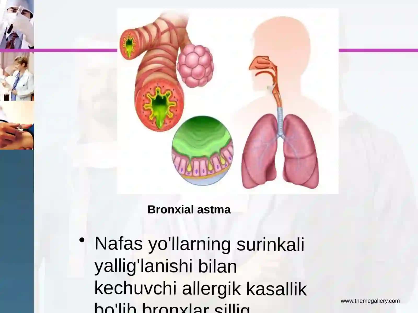 Bronxial astma bolalarda 2