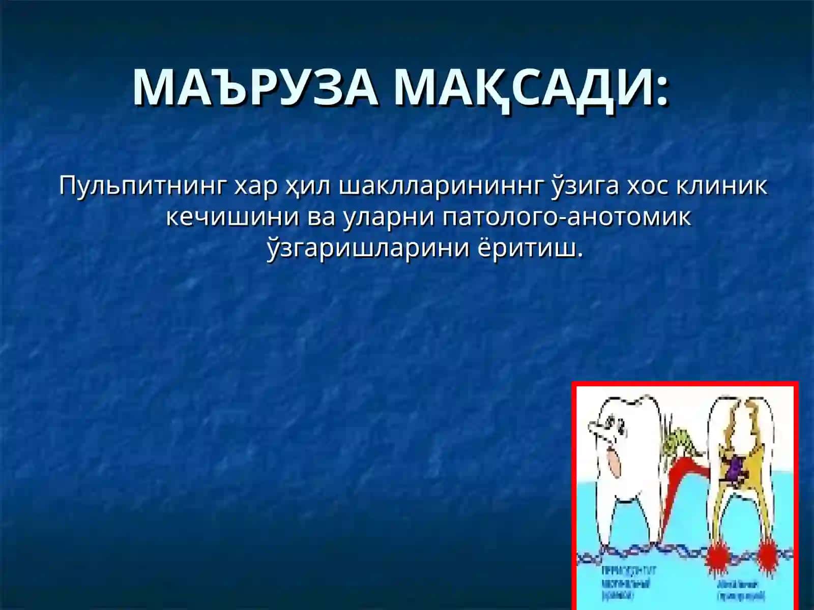 Пульпитларни клиникаси 2