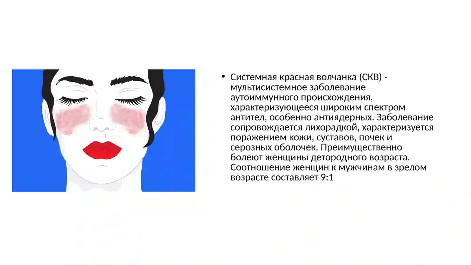 Системная красная волчанка 2