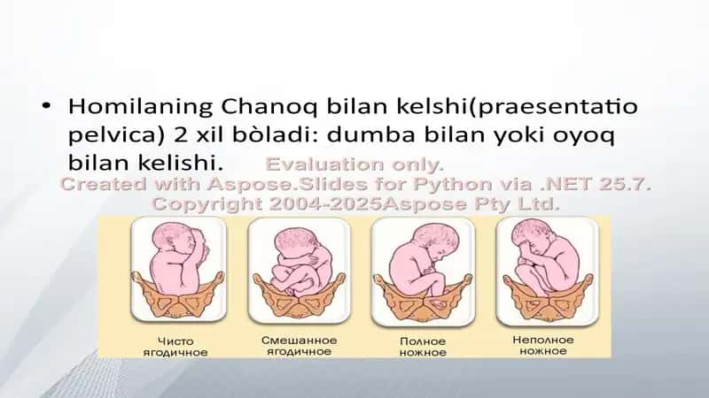 Homilaning Chanoq bilan kelishi 2