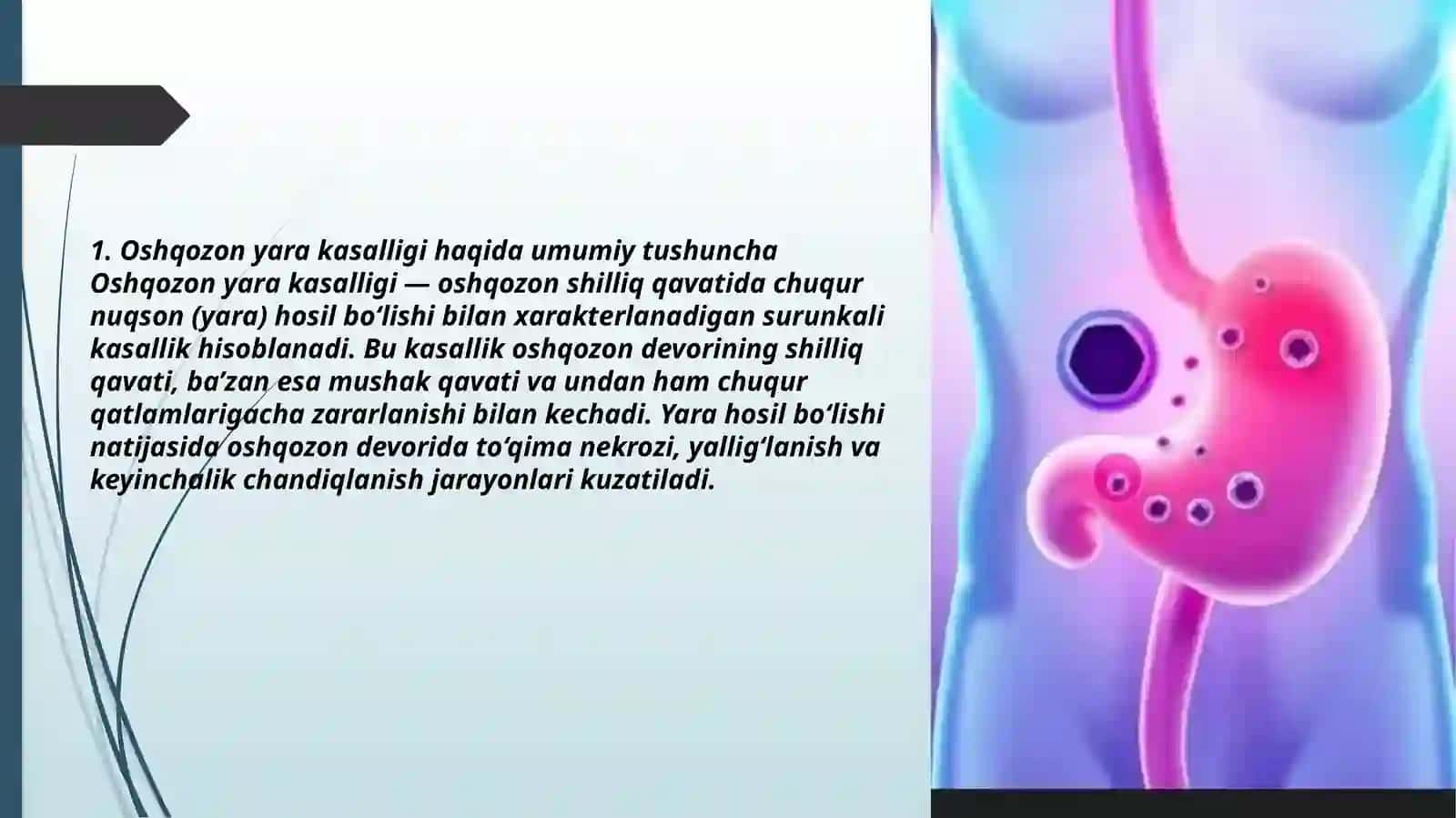 Oshqozon yarasi kasalligi etiopatogenezi 2