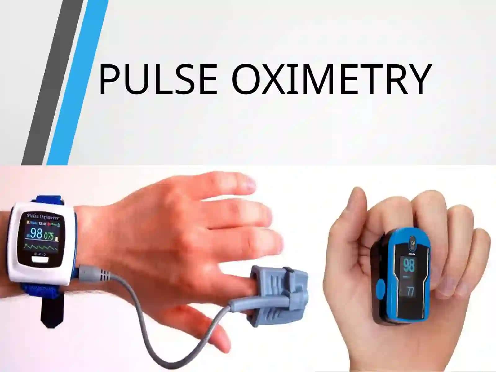 PULSE OXIMETRY AND OXYGEN THERAPY DEVICES 2