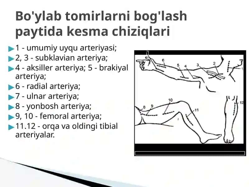 Qon tomir va rentgen endovaskulyar jarrohlik 2