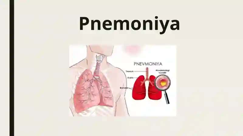 Pnemoniya 2