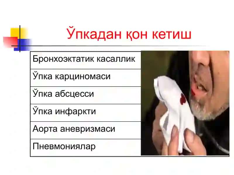 Упка абсцесси 2