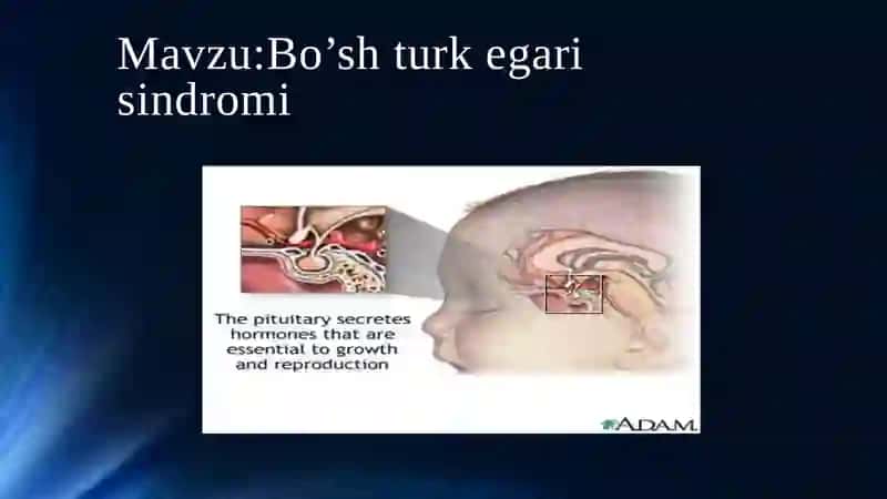 Bo‘shturkegarisindromi 2