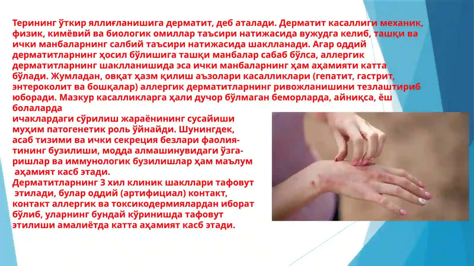 Oddiy va allergik dermatit. Toksik-allergik dermatit. Ekzema 2