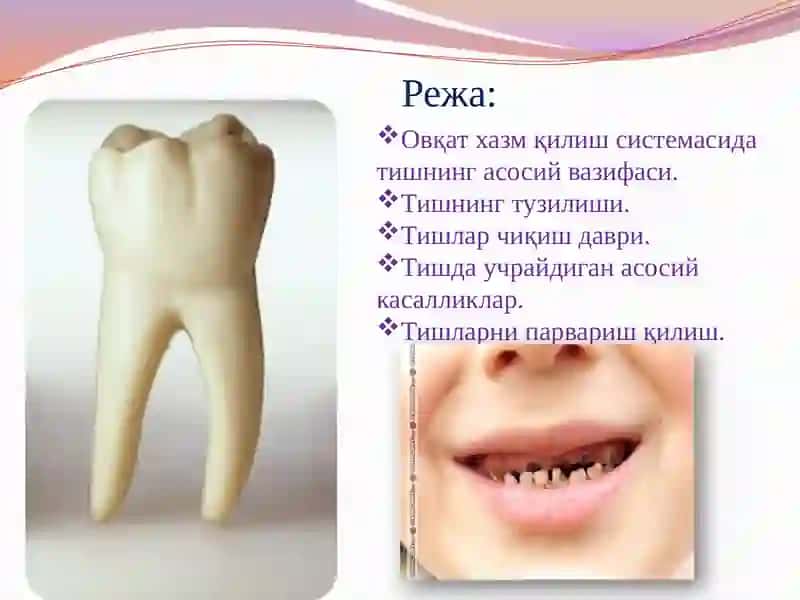 Маржон тишлар 2