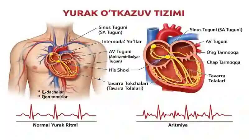 Atrial fibrillyatsiya 2