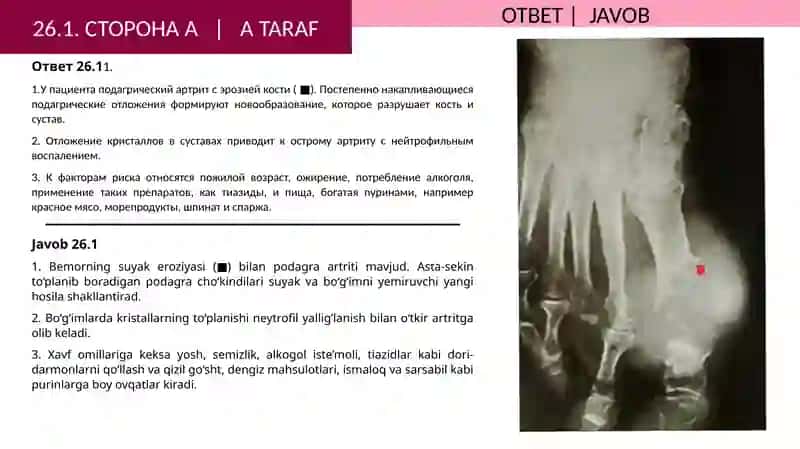 ВОПРОСЫ: СТОРОНАA 2