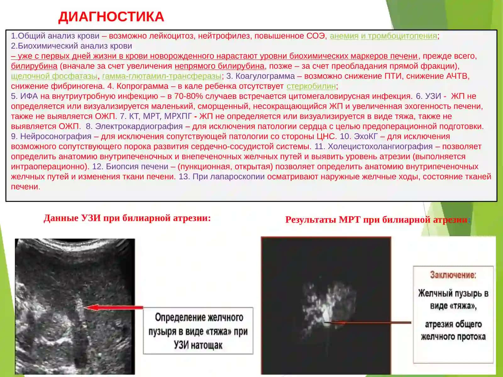 Атрезия желчных протоков 2
