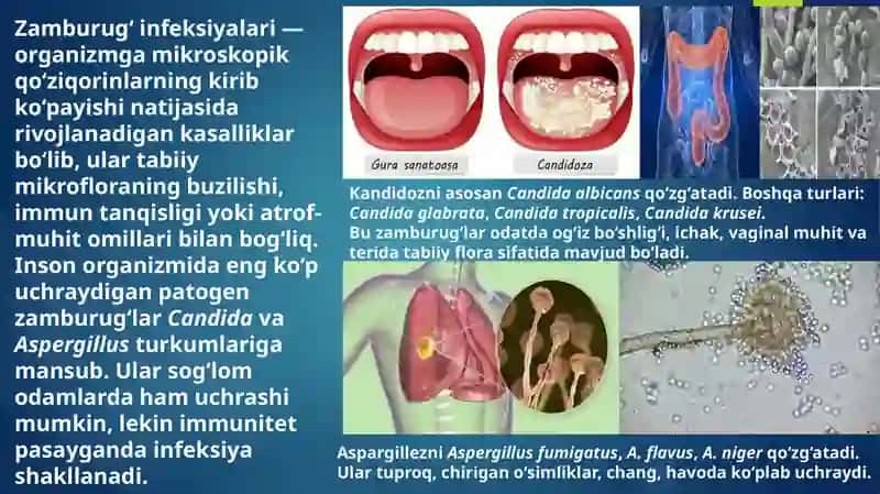 Zamburug' infeksiyalari(kandidoz va aspargillez) 2