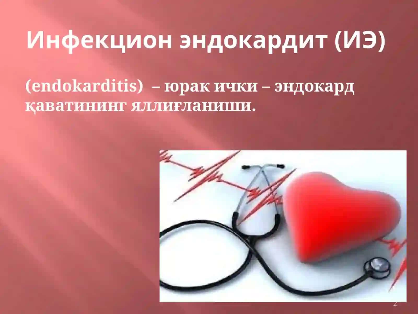 Инфекцион эндокардит 2