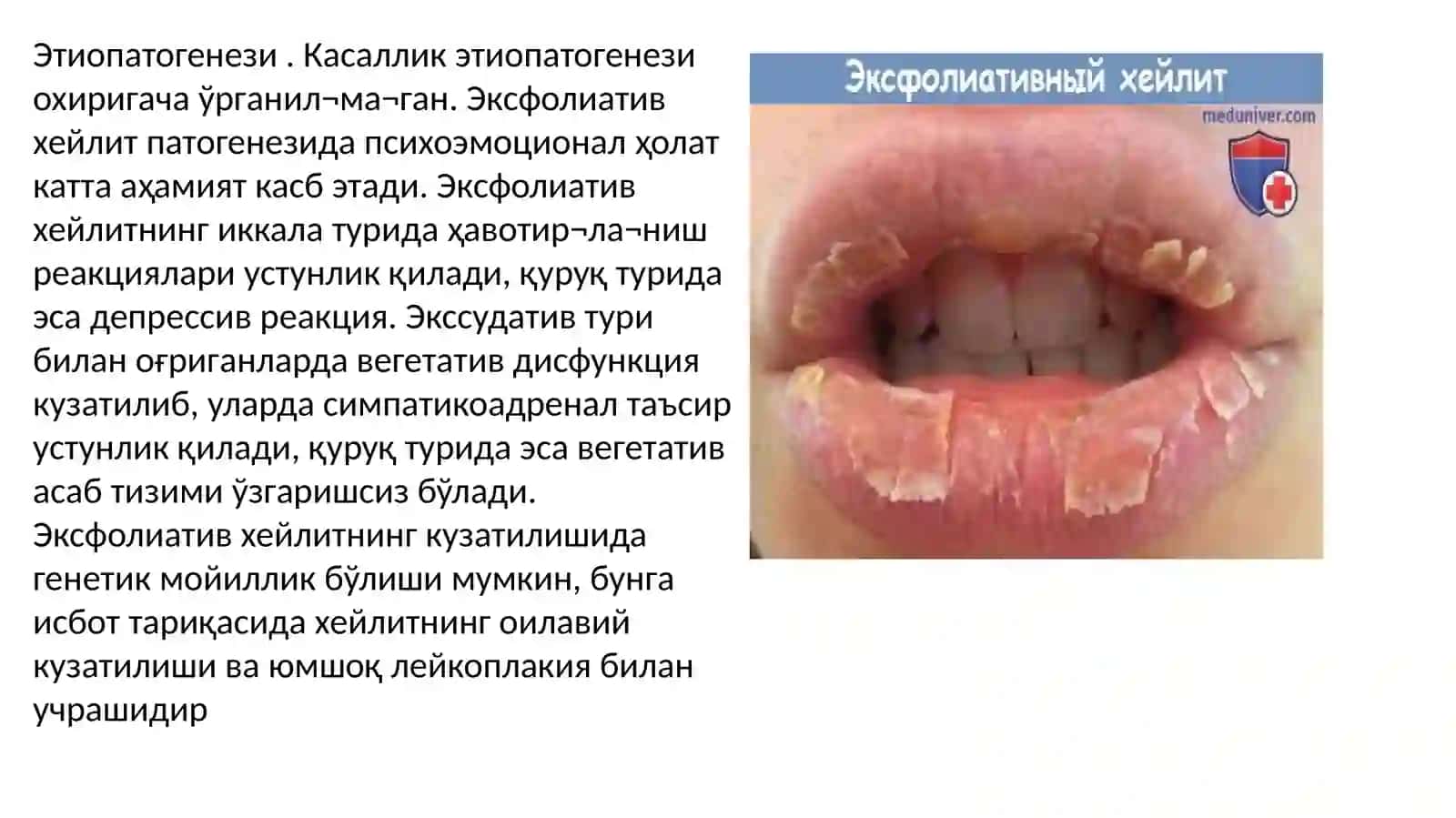 Қуруқ ва эксудатив ҳейлит 2