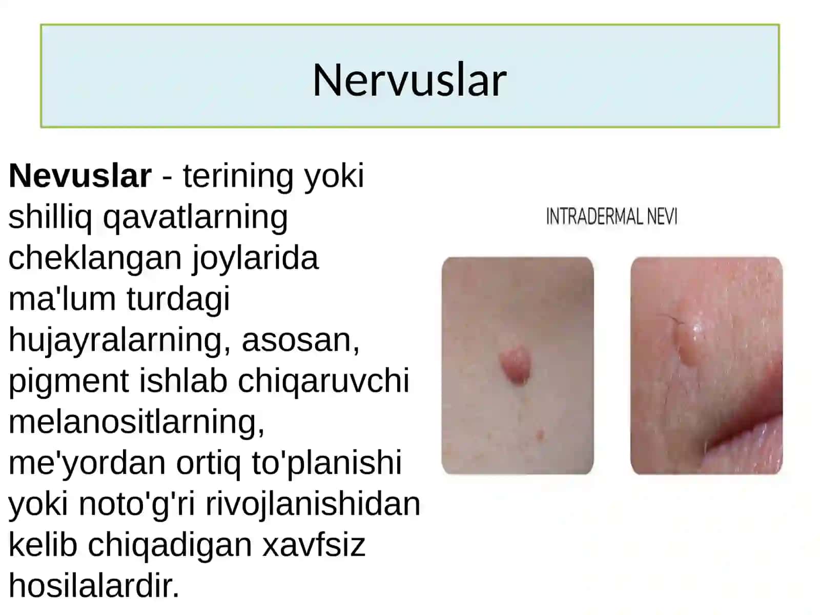 Nevuslar.Ksantelazmalar,lipomalar,gigromalar 2