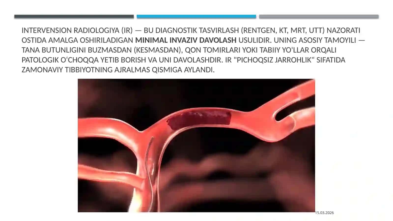 Intervension radiologiya va angiografiya radiologiya 2