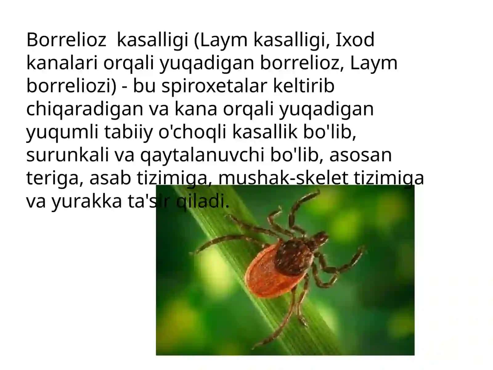 Borrelioz (Laymkasalligi) 2