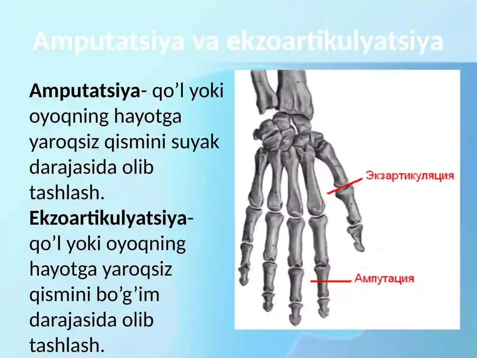 Amputatsiya va ekzoartikulyatsiya 2