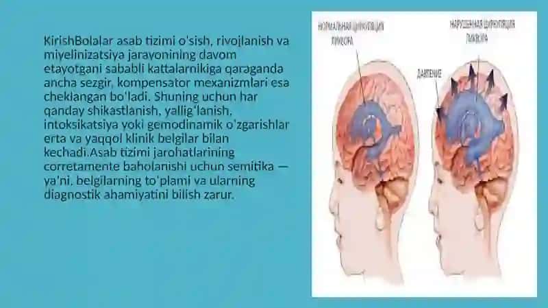 BOLALAR asab tizimi jarohatlanish semiotikasi va sindromlari 2