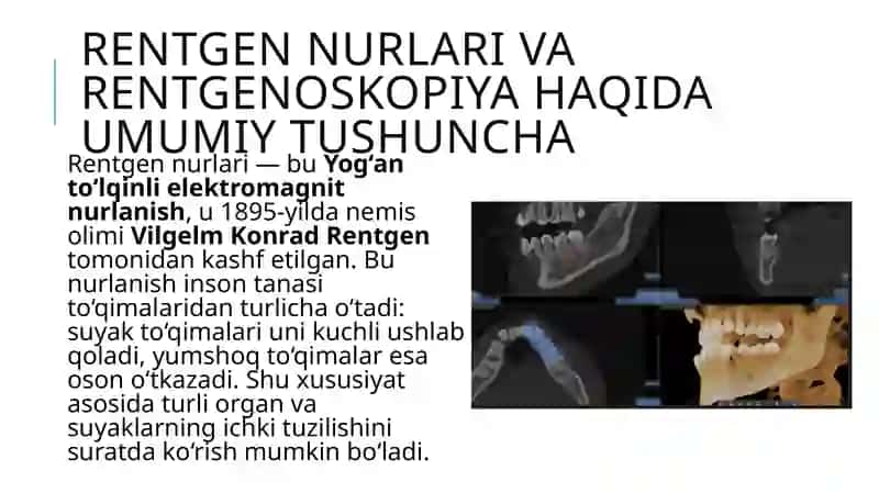 Rentgenoskopiyaning stomatologiyadagi o‘rni 2
