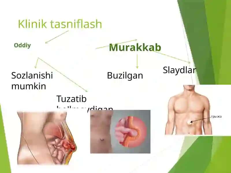 XirurgiyavaBolalarxirurgiyasikafedrasi 2