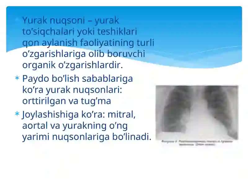YURAKNING MITRAL POROGI VA STENOZI 2