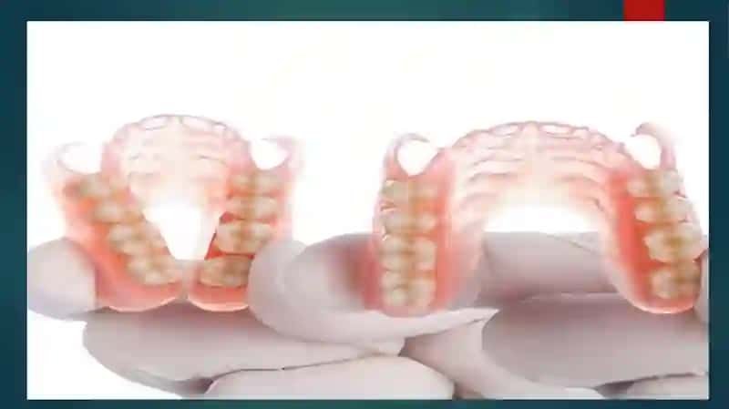 KARDOTTIYOYLI PROTEZLARNI TAYYORLASH 2
