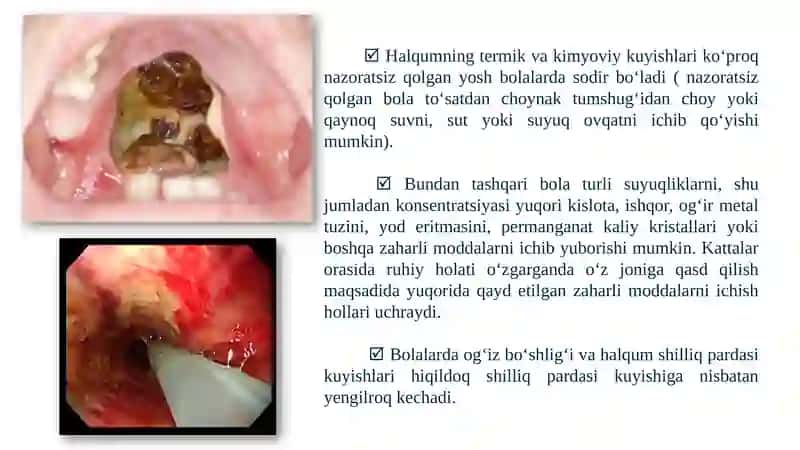 HALQUM KUYISHLARI 2