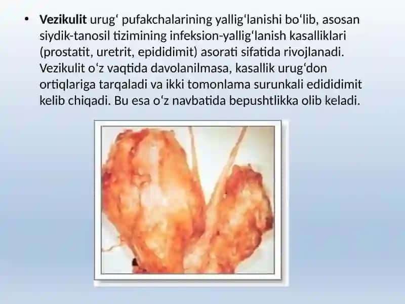 ERKAKLAR TANOSIL A`ZOLARI.AYOLLAR TANOSIL A`ZOLARI 2